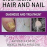 Disorders of the Hair and Nail: Diagnosis and Treatment 1st Edition