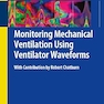 Monitoring Mechanical Ventilation Using Ventilator Waveforms 1st ed