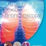 Atlas of Flexible Bronchoscopy 1st Edition