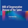 MRI of Degenerative Disease of the Spine: A Case-Based Atlas 2nd Edition