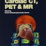 Cardiac CT, PET and MR