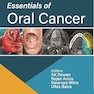 Essentials of Oral Cancer