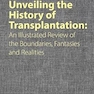 Unveiling the History of Transplantation: An Illustrated Review of the Boundaries, Fantasies and Realities 1st Edition