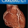 The Complete Guide to Cardiac CT 1st Edition