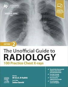 The Unofficial Guide to Radiology: 100 Practice Chest X-rays 2nd Edition
