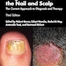 Fungal Infections of the Nail and Scalp: The Current Approach to Diagnosis and Therapy 3rd Edition