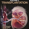 Textbook of Kidney Transplantation 1st Edition