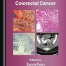 Hereditary and Familial Colorectal Cancer 1st Edition