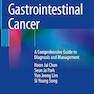 Gastrointestinal Cancer: A Comprehensive Guide to Diagnosis and Management