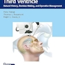 Colloid Cysts of the Third Ventricle: Natural History, Decision-Making, and Operative Management 1st Edition