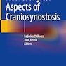 Neurosurgical Aspects of Craniosynostosis