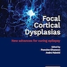 Focal Cortical Dysplasias: New advances for curing epilepsy