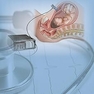 Actocardiogram: Analysis of Fetal Motion and Heart Rate 1st Edition