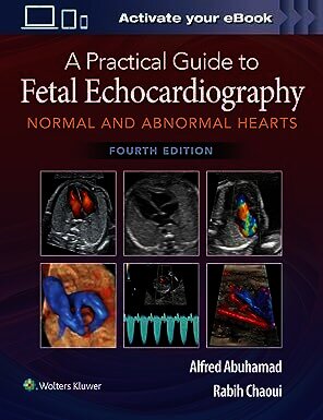 A Practical Guide to Fetal Echocardiography: Normal and Abnormal Hearts Fourth Edition