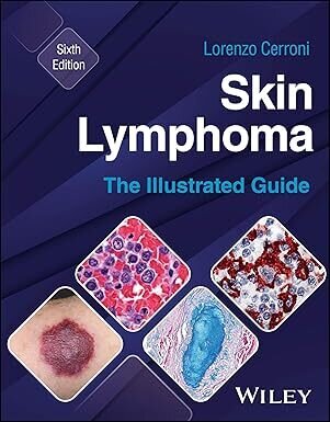 عکس Skin Lymphoma: The Illustrated Guide 6th Edition
